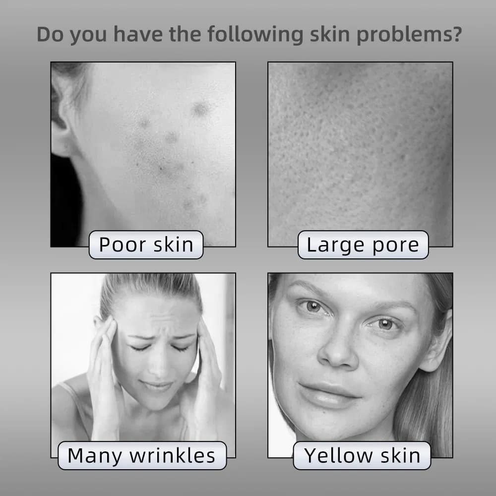 Firming Red Light Therapy LED Face Mask — Silicone detail 6