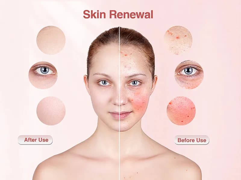 Anti-Aging Red Light Therapy LED Face Mask — 460nm + 605nm + 630nm, 70 LEDs — 1060541852 Edition detail 3