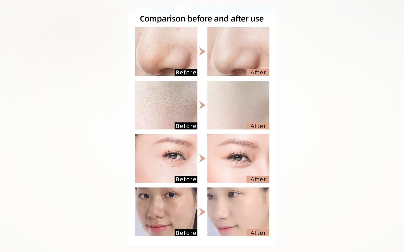 Red Light Therapy LED Face & Neck Mask — Silicone, 460nm + 590nm + 630nm, 240 LEDs detail 4