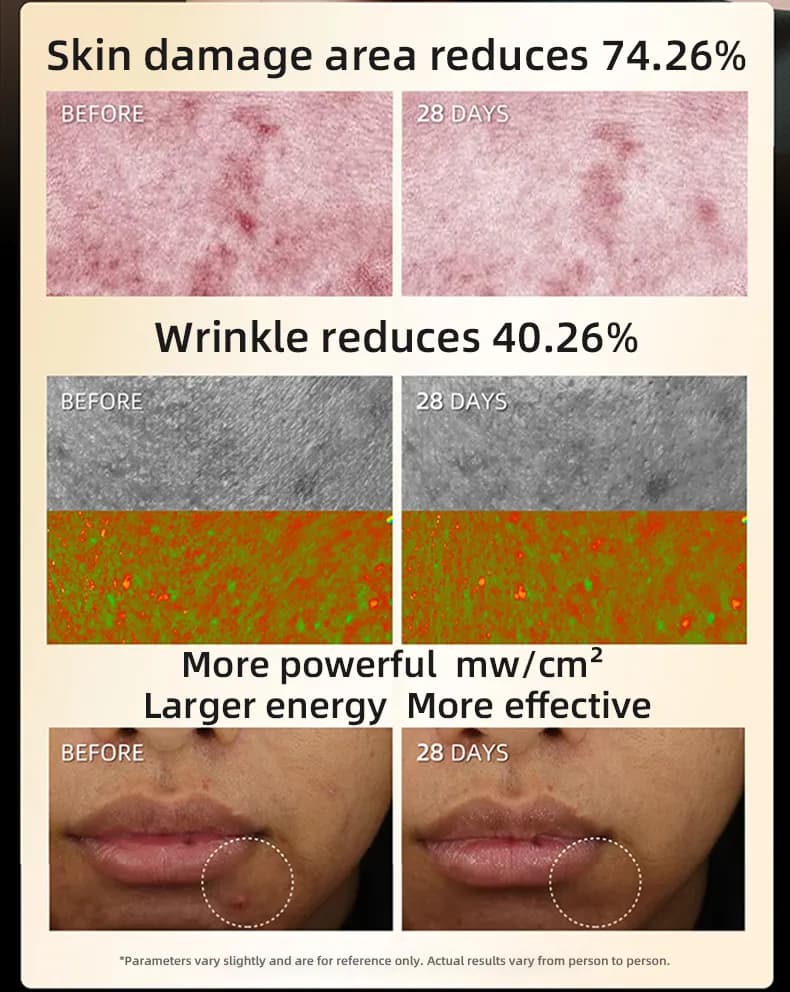 Red Light Therapy LED Face Mask — Near Edition detail 4