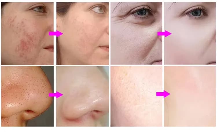 Red Light Therapy LED Face Mask — Silicone, 7-Color — Cleopatra Edition detail 6