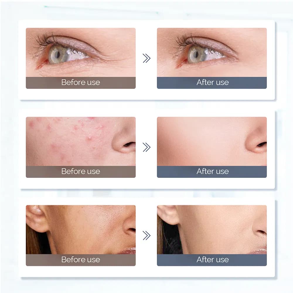 Anti-Wrinkle Red Light Therapy LED Face & Neck Mask — Silicone, 7 LEDs detail 2