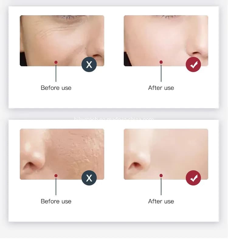 Red Light Therapy LED Face Mask — 8-Color detail 3