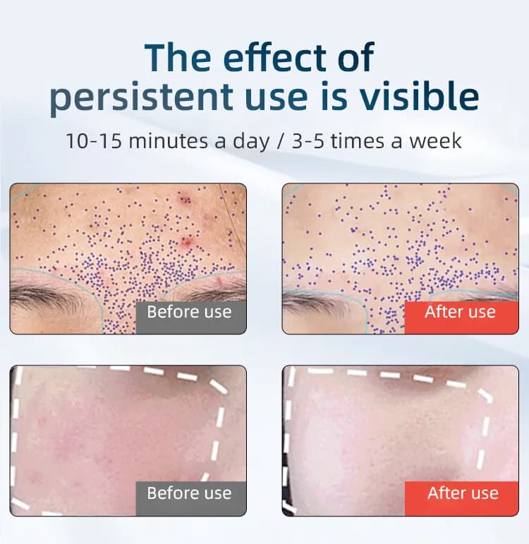 Red Light Therapy LED Face Mask — Advanced Edition detail 6