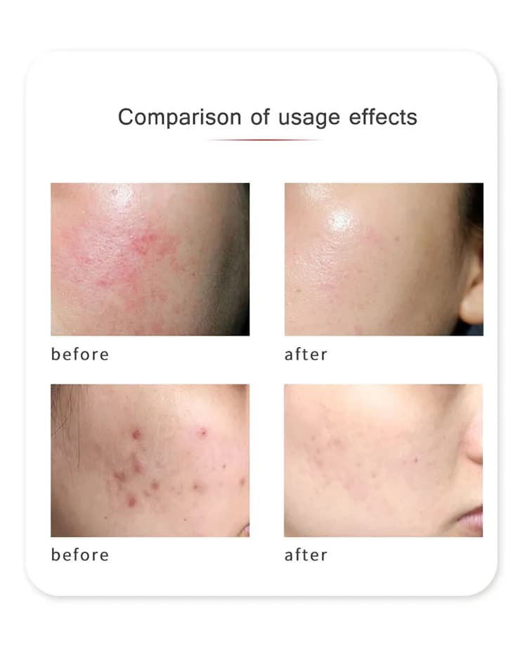 Anti-Wrinkle Red Light Therapy LED Face Mask — Product Edition detail 5