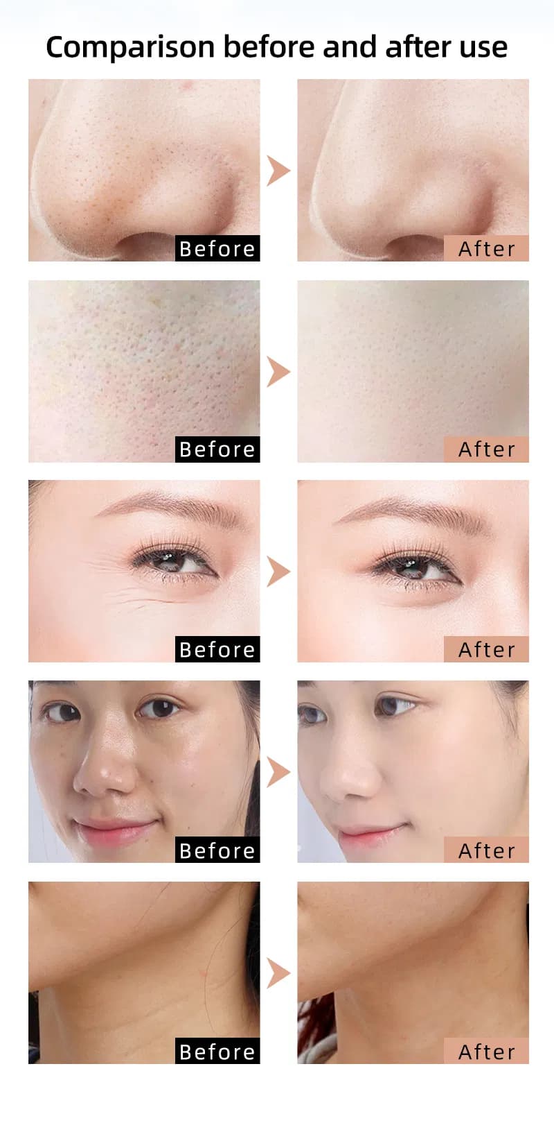 Anti-Aging Red Light Therapy LED Face & Neck Mask — Near-Infrared 850nm, Portable detail 6