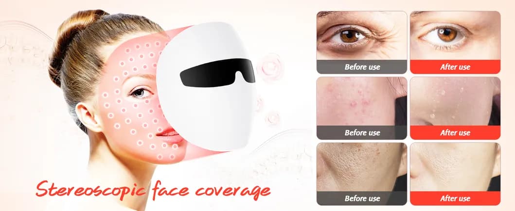 Acne Treatment Red Light Therapy LED Face Mask — 7-Color detail 2