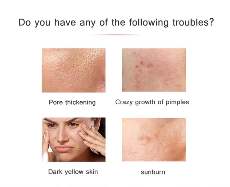 Anti-Wrinkle Red Light Therapy LED Face Mask — Product Edition detail 2